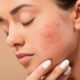 How to Choose Products for Sensitive Skin?