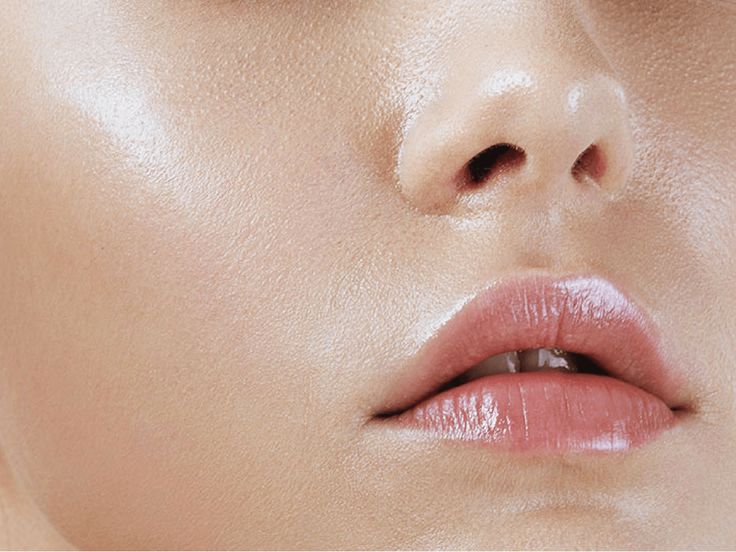 Oily Skin